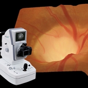 image of 3D retinal image using the kowa camera