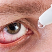 image of a dry red irritated eye.