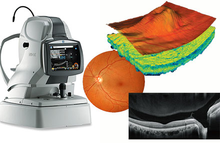 image of an Ocular coherence tomographer and scan of the retina