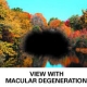 how macula degeneraton affects your central vision