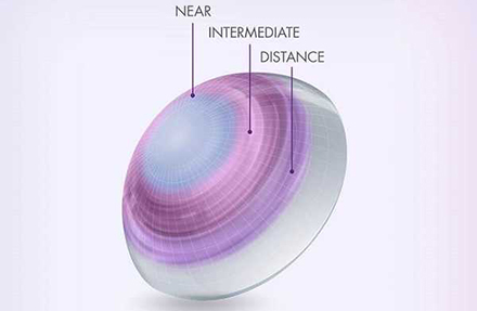 image of how a multifocal contact lens worked
